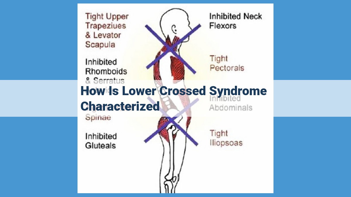 Lower Crossed Syndrome: A Comprehensive Guide to Postural Imbalance and its Effects