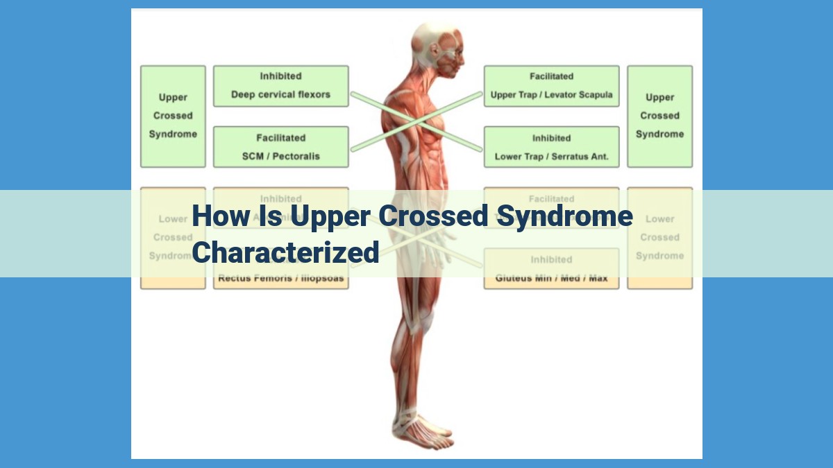 Understanding Upper Crossed Syndrome: Causes, Symptoms, and Treatment