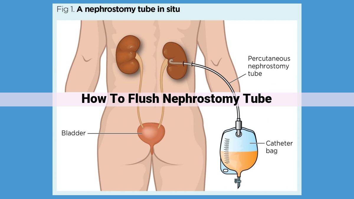 Nephrostomy Tube Flushing: A Comprehensive Guide to Maintain Patency and Patient Comfort