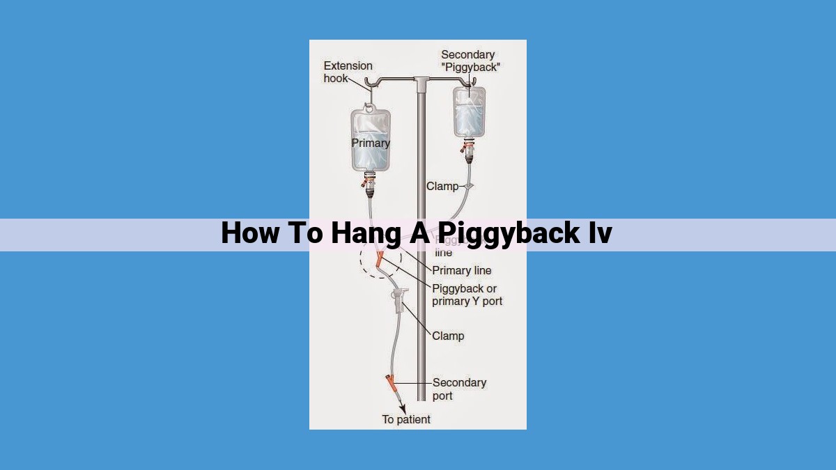 Comprehensive Guide to Administering Piggyback IV Therapy: Sterility, Site Selection, Monitoring, and Troubleshooting