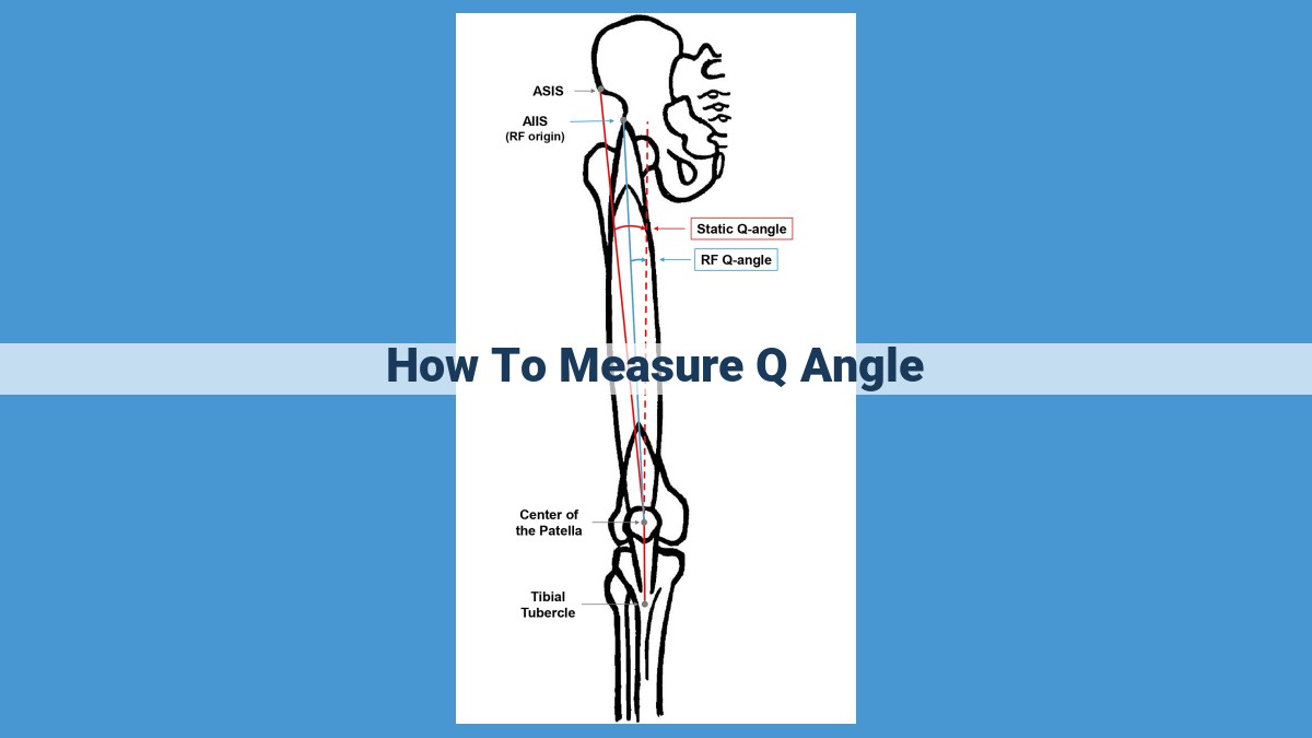 Understanding Q Angle: A Guide to Measuring Knee Alignment